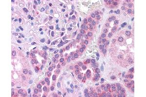 MAF antibody was used for immunohistochemistry at a concentration of 4-8 ug/ml. (MAF anticorps  (N-Term))