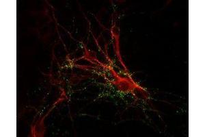 Image no. 1 for anti-Synapsin I (SYN1) antibody (ABIN372716)