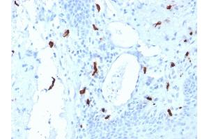 Formalin-fixed, paraffin-embedded human Tonsil stained with Tryptase Mouse Monoclonal Antibody (TPSAB1/1961). (TPSAB1 anticorps  (AA 115-233))