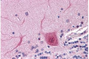 anti-Actin-Related Protein 2 (ACTR2) (AA 40-311) antibody