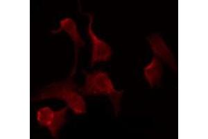 ABIN6276109 staining A549 by IF/ICC.