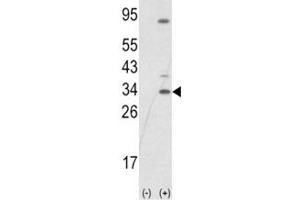 Western blot analysis of SNAI1 antibody and 293 cell lysate (2 ug/lane) either nontransfected (Lane 1) or transiently transfected with the SNAIL gene (2). (SNAIL anticorps  (AA 1-30))