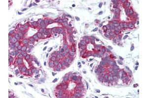 Image no. 1 for anti-Tumor Necrosis Factor (Ligand) Superfamily, Member 11 (TNFSF11) antibody (ABIN302887) (RANKL anticorps)