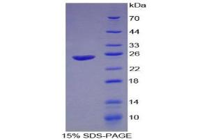 SDS-PAGE (SDS) image for Interferon alpha (IFNA) (AA 1-187) protein (His tag) (ABIN1879840)