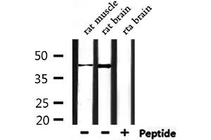 Western blot analysis of extracts from rat muscle and rat brain, using CHST14 Antibody.
