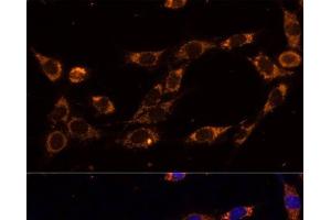 Immunofluorescence analysis of NIH-3T3 cells using TRAP1 Polyclonal Antibody at dilution of 1:100 (40x lens).