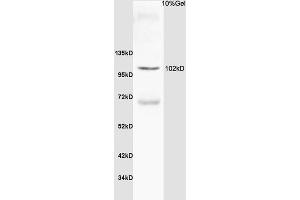 Rat thyroid lysate probed with Anti Thyroid peroxidase Polyclonal Antibody, Unconjugated (ABIN668736) at 1:200 overnight at 4 °C. (Thyroperoxidase anticorps  (AA 351-450))