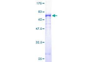 Image no. 1 for Gasdermin B (GSDMB) (AA 1-411) protein (GST tag) (ABIN1306024)