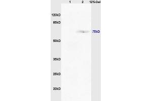 Lane 1: mouse intestine lysates Lane 2: mouse lung lysates probed with Anti TAP2/ABCB3 Polyclonal Antibody, Unconjugated (ABIN680123) at 1:200 in 4 °C. (TAP2 anticorps  (AA 451-550))