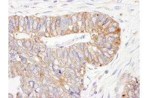 Immunohistochemistry (IHC) image for anti-Protein Disulfide Isomerase Family A, Member 6 (PDIA6) (AA 250-300) antibody (ABIN7453940) (PDIA6 anticorps  (AA 250-300))
