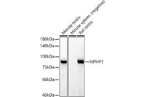 Western blot analysis of extracts of various cell lines, using NPHP1 antibody (ABIN7268847) at 1:1000 dilution. (NPHP1 anticorps)