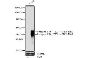 Western blot analysis of extracts of Jurkat cells, using Phospho-ERK1-T202 + ERK2-T185 Rabbit mAb (ABIN7268610) at 1:1000 dilution. (ERK1/2 anticorps  (pThr185, pThr202))