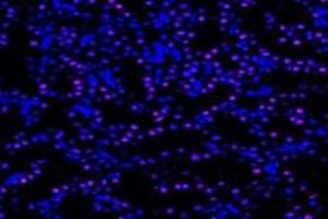 Immunofluorescent analysis of paraformaldehyde-fixed rat kidney using,UCKL1 (ABIN7076157) at dilution of 1: 4000 (UCKL1 anticorps)