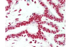 Anti-SMC1A / SMC1 antibody IHC staining of human breast. (SMC1A anticorps  (C-Term))