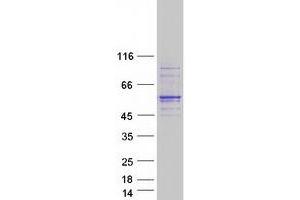 Validation with Western Blot