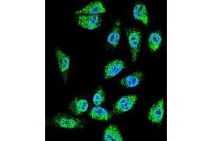 Confocal immunofluorescent analysis of MDA-MBA231 cells using C18orf8/MIC1 Antibody (N-term), followed by Alexa Fluor 488-conjugated goat anti-rabbit lgG (green).