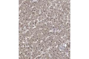 Immunohistochemical analysis of C on paraffin-embedded Human liver tissue. (Cyclin Y anticorps  (AA 140-169))