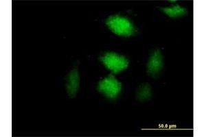 Immunofluorescence of purified MaxPab antibody to CLIC3 on HeLa cell. (CLIC3 anticorps  (AA 1-236))