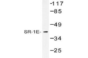 Western blot (WB) analysis of SR-1E antibody in extracts from HeLa cells. (Serotonin Receptor 1E anticorps)