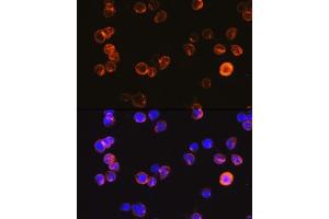 Immunofluorescence analysis of Jurkat cells using CD3E Antigen antibody (ABIN6134272, ABIN6138181, ABIN6138184 and ABIN6216032) at dilution of 1:100. (CD3 epsilon anticorps  (C-Term))