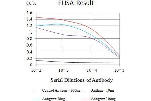 Black line: Control Antigen (100 ng),Purple line: Antigen (10 ng), Blue line: Antigen (50 ng), Red line:Antigen (100 ng)