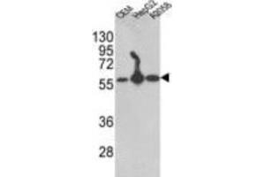 Western Blotting (WB) image for anti-Prolyl 4-Hydroxylase, beta Polypeptide (P4HB) antibody (ABIN3001707) (P4HB anticorps)