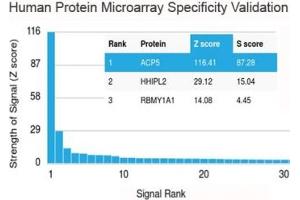 Analysis of HuProt(TM) microarray containing more than 19,000 full-length human proteins using recombinant TRAcP antibody (clone rACP5/1070). (ACP5 anticorps)