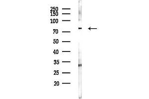 Western blot analysis of lysates from LoVo cells(heat-shock,45 min treatment), using Collagen Type XXIII Antibody at 1/1000 dilution.