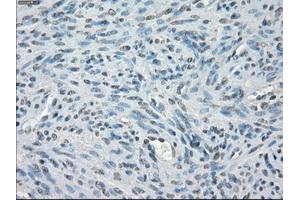 Immunohistochemical staining of paraffin-embedded Ovary tissue using anti-PPP5Cmouse monoclonal antibody. (PP5 anticorps)