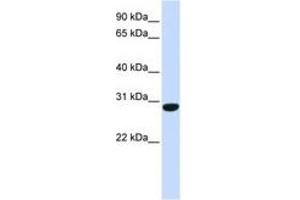 Image no. 1 for anti-Protein FAM164B (ZC2HC1B) (C-Term) antibody (ABIN6741093) (FAM164B anticorps  (C-Term))