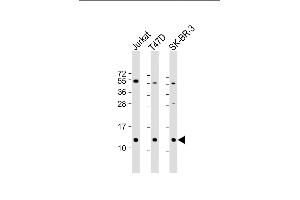 All lanes : Anti-TFF1 Antibody (Center) at 1:2000 dilution Lane 1: Jurkat whole cell lysate Lane 2: T47D whole cell lysate Lane 3: SK-BR-3 whole cell lysate Lysates/proteins at 20 μg per lane. (TFF1 anticorps  (AA 11-40))