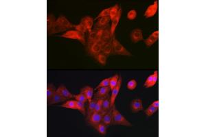 Immunofluorescence analysis of NIH/3T3 cells using NDUFB8 Rabbit pAb (ABIN7268814) at dilution of 1:100 (40x lens).
