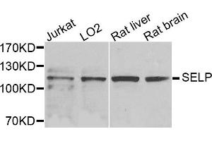Western blot analysis of extracts of various cells, using SELP antibody. (P-Selectin anticorps)