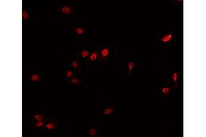ABIN6266740 staining HeLa cells by IF/ICC.