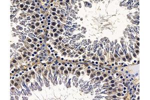 ABIN7095083 and ABIN7099139 at 1/100 staining rat testis tissue by IHC-P. (SRRT anticorps)