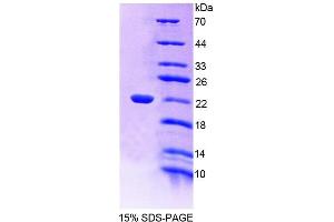 SDS-PAGE analysis of Human EDF1 Protein.