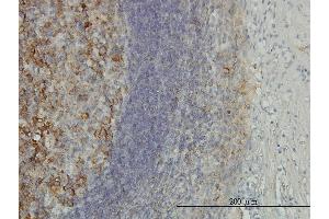 Immunoperoxidase of monoclonal antibody to PSMD10 on formalin-fixed paraffin-embedded human tonsil.