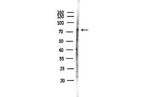 anti-Activating Transcription Factor 6 beta (ATF6B) (Internal Region) antibody