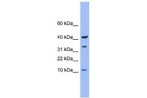 CASP6 antibody used at 0. (Caspase 6 anticorps  (Middle Region))