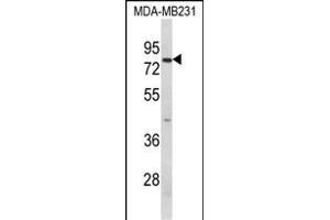 Western blot analysis of RANBP9 Antibody (Center) (ABIN652440 and ABIN2842299) in MDA-M cell line lysates (35 μg/lane). (Importin 9 anticorps  (AA 339-367))