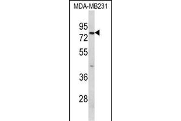 Importin 9 anticorps  (AA 339-367)