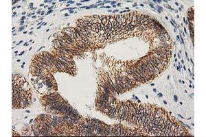 Image no. 4 for anti-Catenin (Cadherin-Associated Protein), beta 1, 88kDa (CTNNB1) antibody (ABIN1496888)