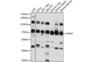 Western blot analysis of extracts of various cell lines, using PGM2 antibody. (Phosphoglucomutase 2 anticorps)