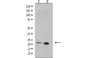 Western blot analysis of extracts from various samples, using CRH Antibody.