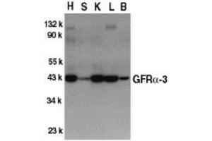Western blot analysis of GFR alpha 3 in crude cell membrane fractions of mouse heart (H), spleen (S), kidney (K), liver (L), and brain (B), respectively, with AP30363PU-N GFR alpha 3 antibody at 1/500 dilution. (GFRA3 anticorps  (Intermediate Domain))