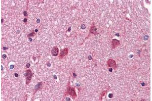 Human Brain, cortex: Formalin-Fixed, Paraffin-Embedded (FFPE)