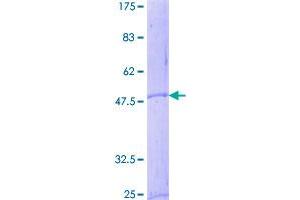 Image no. 1 for Corticotropin Releasing Hormone (CRH) (AA 1-196) protein (GST tag) (ABIN1350330)