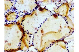 Immunohistochemistry of paraffin-embedded human thyroid tissue using ABIN7153969 at dilution of 1:100 (GRIK1 anticorps  (AA 675-834))