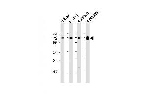 PLA2G7 anticorps  (AA 200-228)