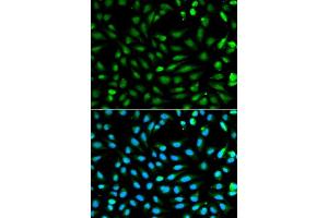 anti-Proliferating Cell Nuclear Antigen (PCNA) (AA 1-261) antibody
